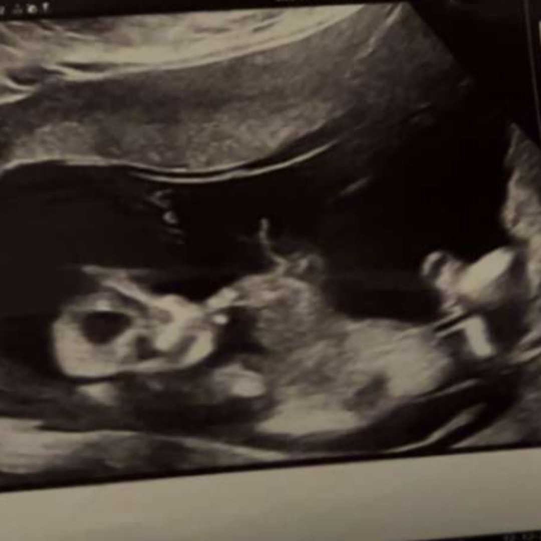 Photo shared by Emma for their Babylist baby registry.