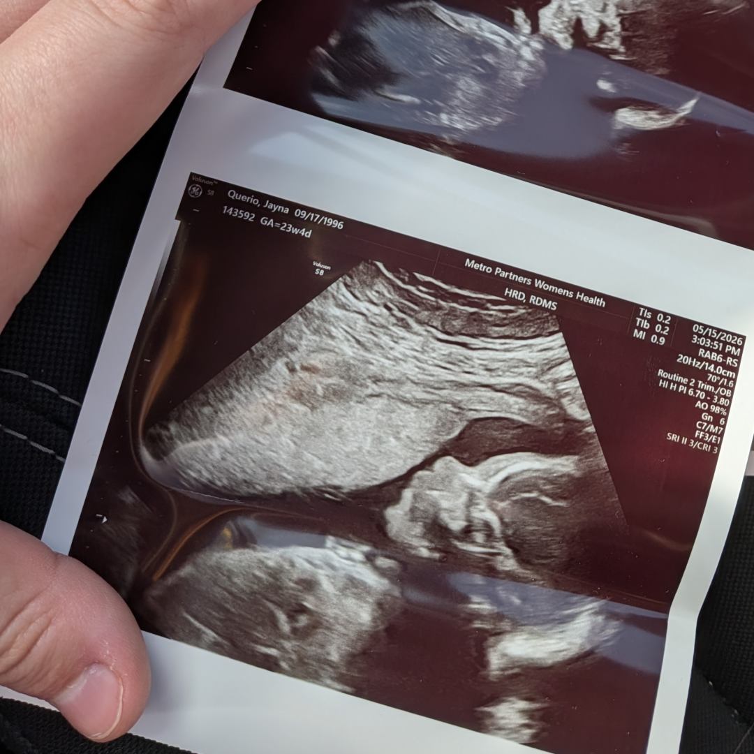 Photo shared by Jayna for their Babylist baby registry.