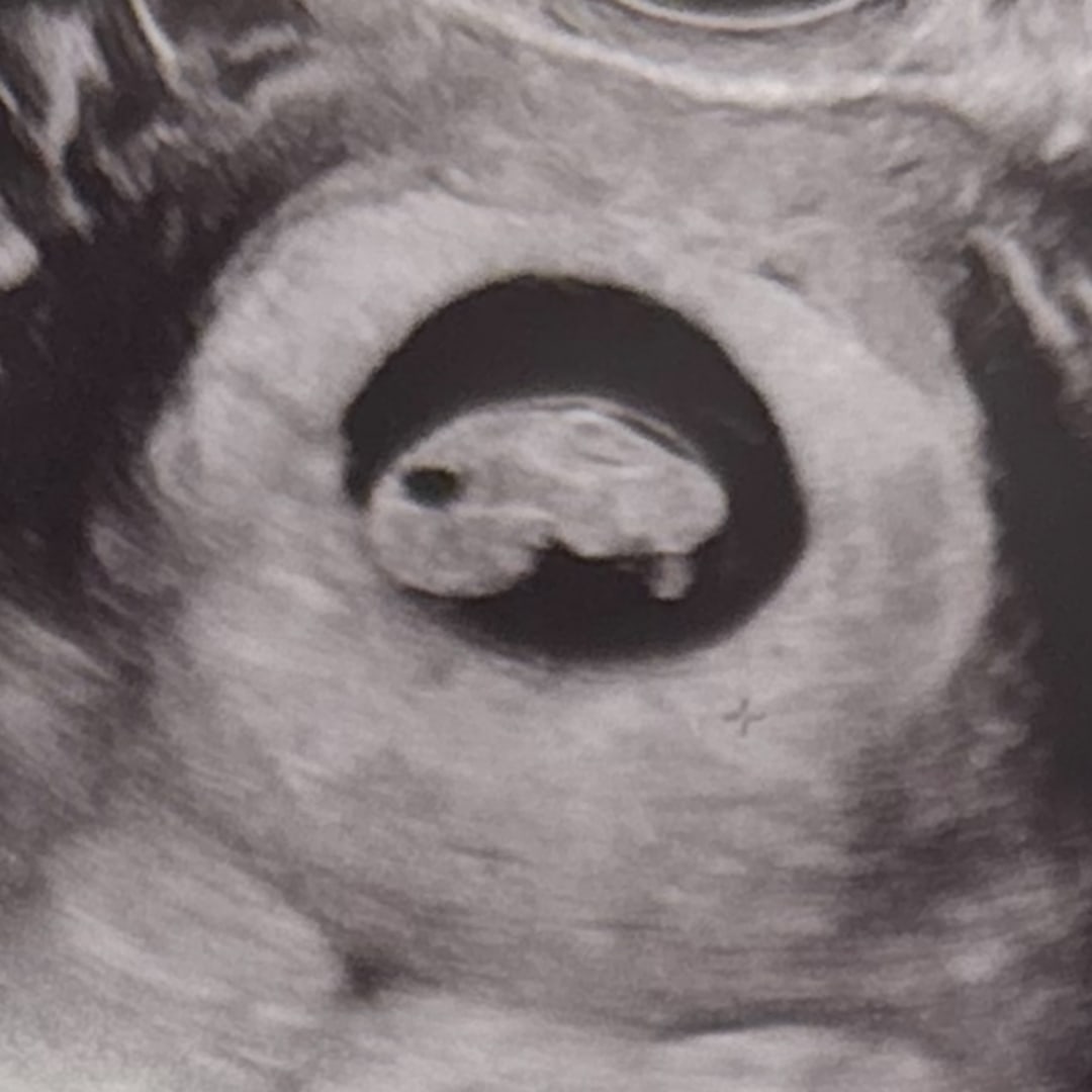 Photo shared by Tarissa for their Babylist baby registry.