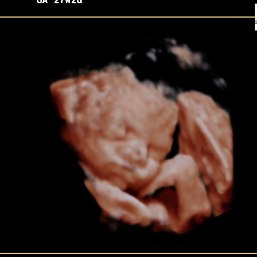 Photo shared by Alyssa for their Babylist baby registry.