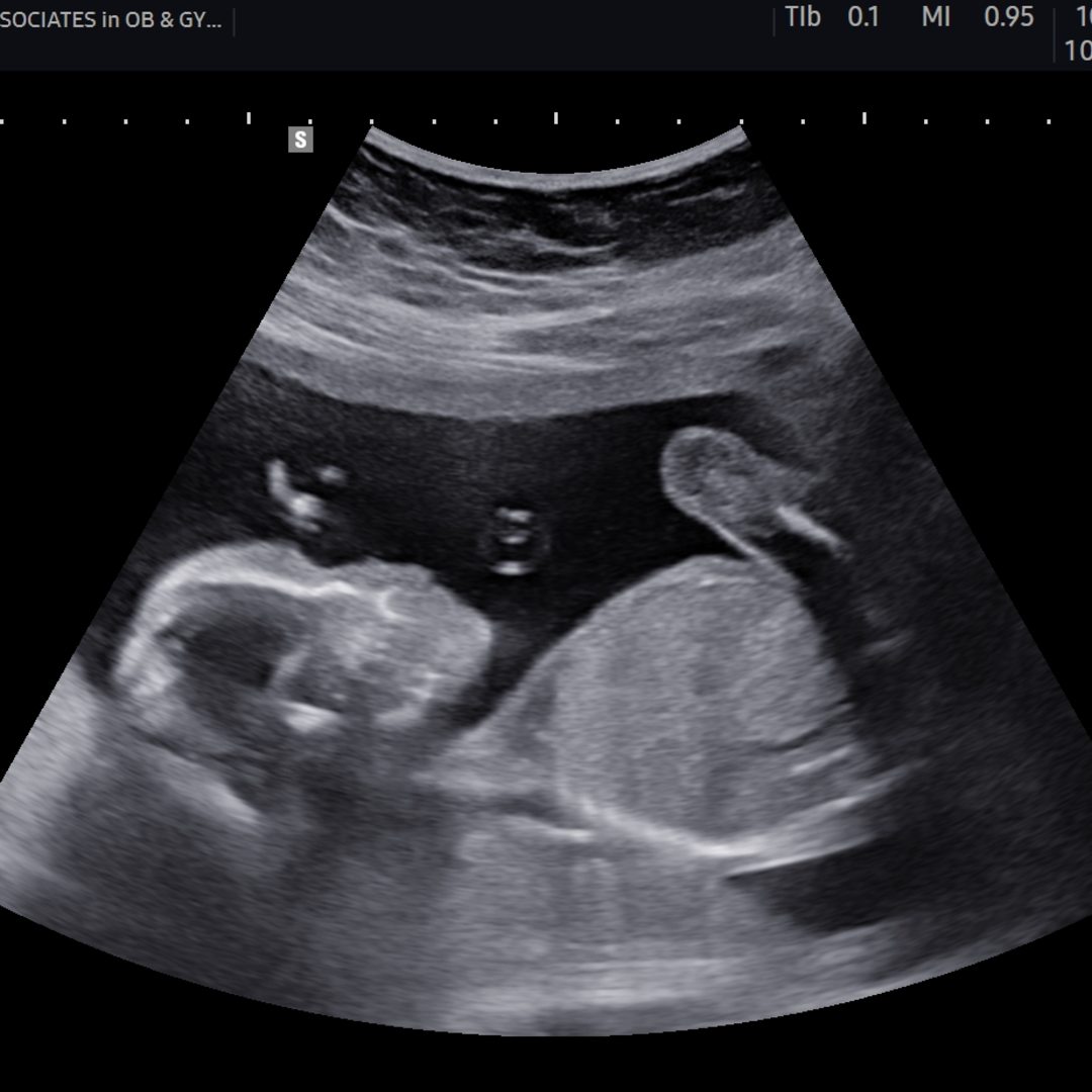 Photo shared by Stephanie for their Babylist baby registry.