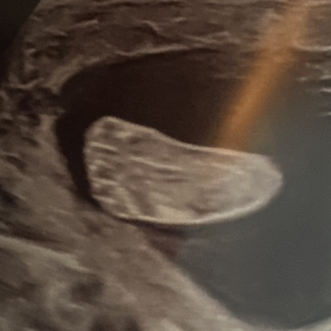 Photo shared by Rosalind for their Babylist baby registry.