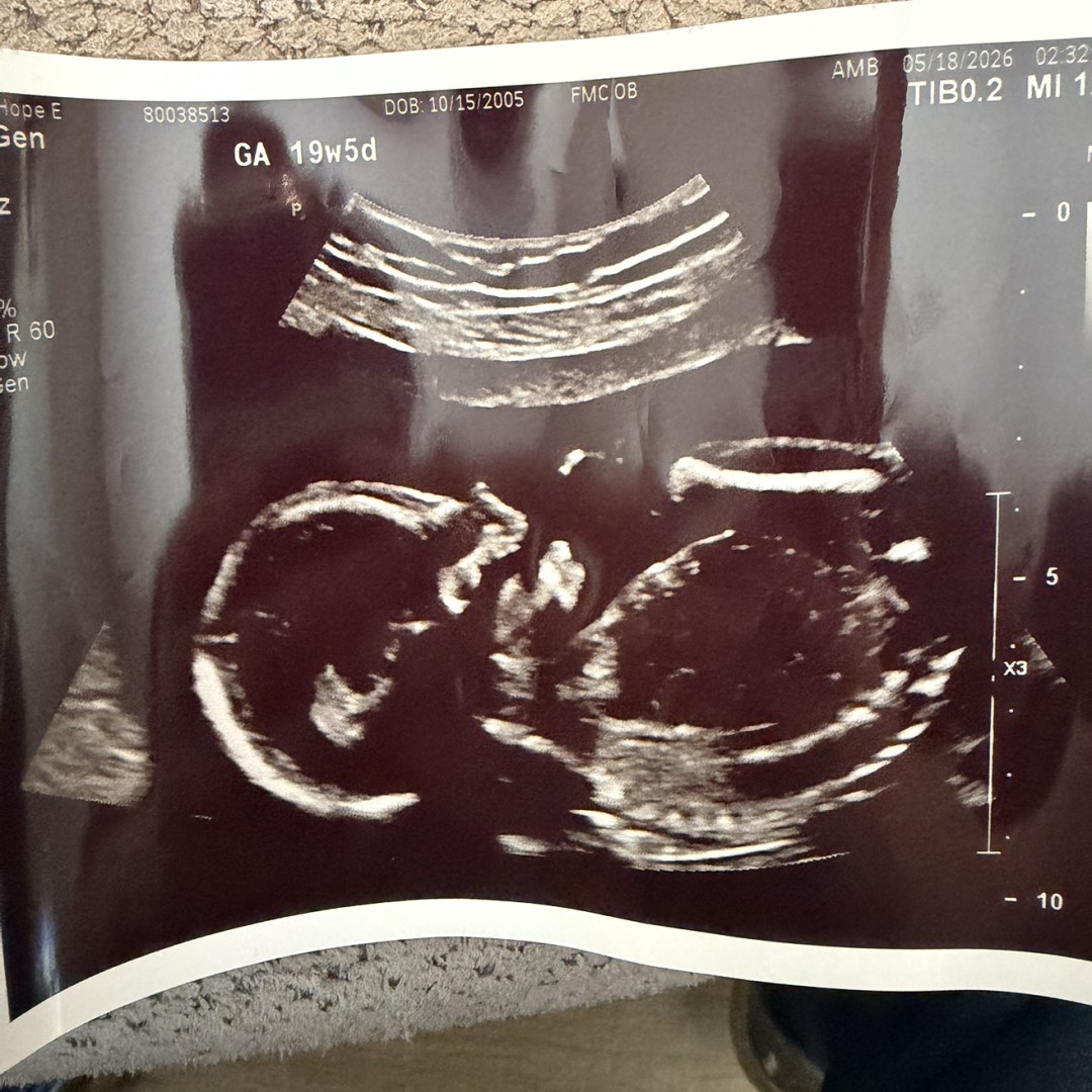 Photo shared by Hope for their Babylist baby registry.