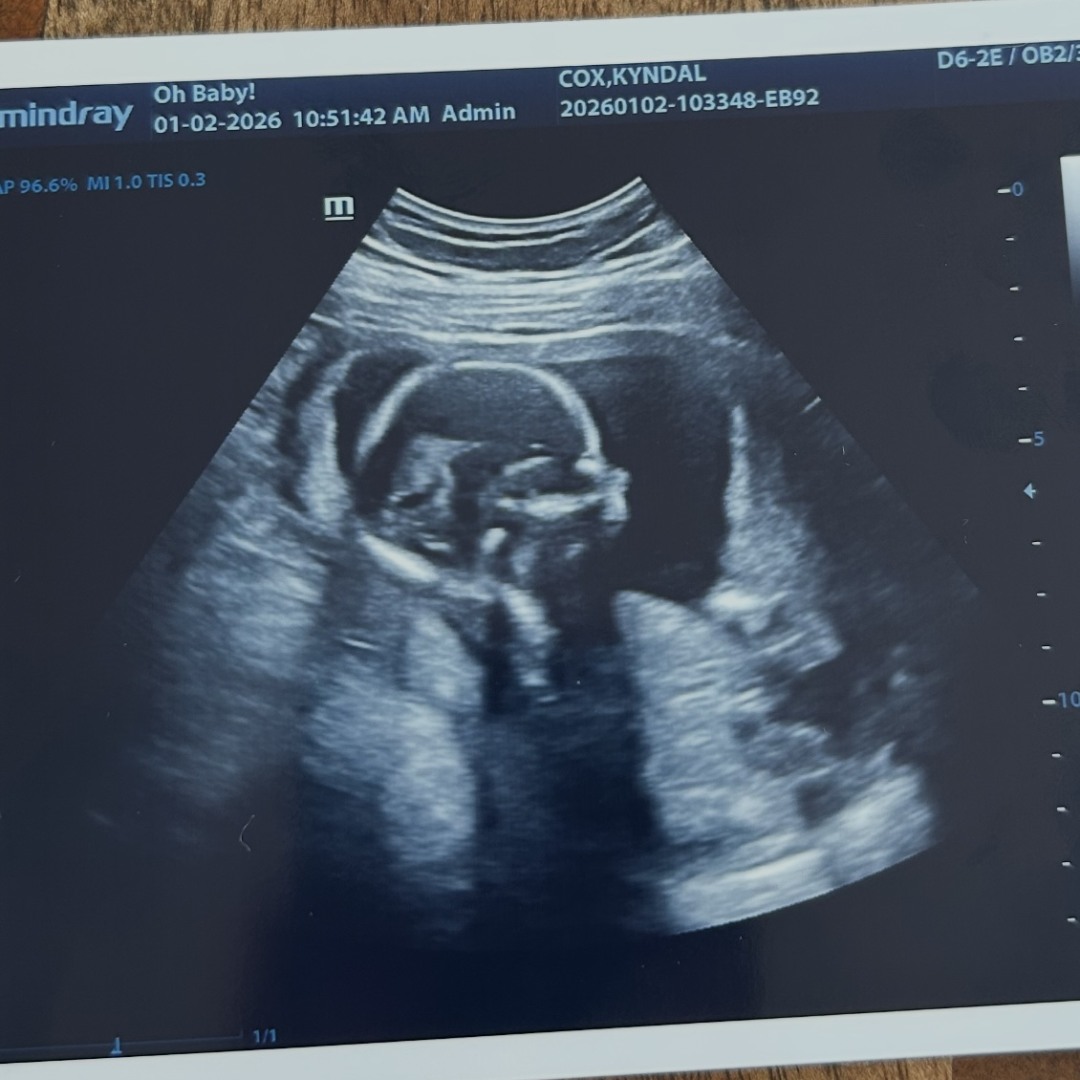 Photo shared by Kyndal for their Babylist baby registry.