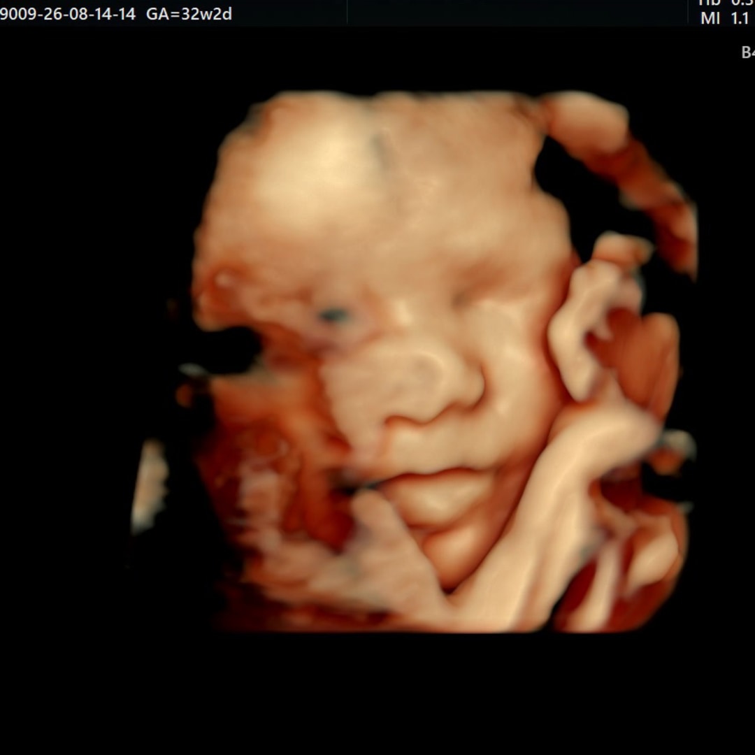 Photo shared by Barbra for their Babylist baby registry.