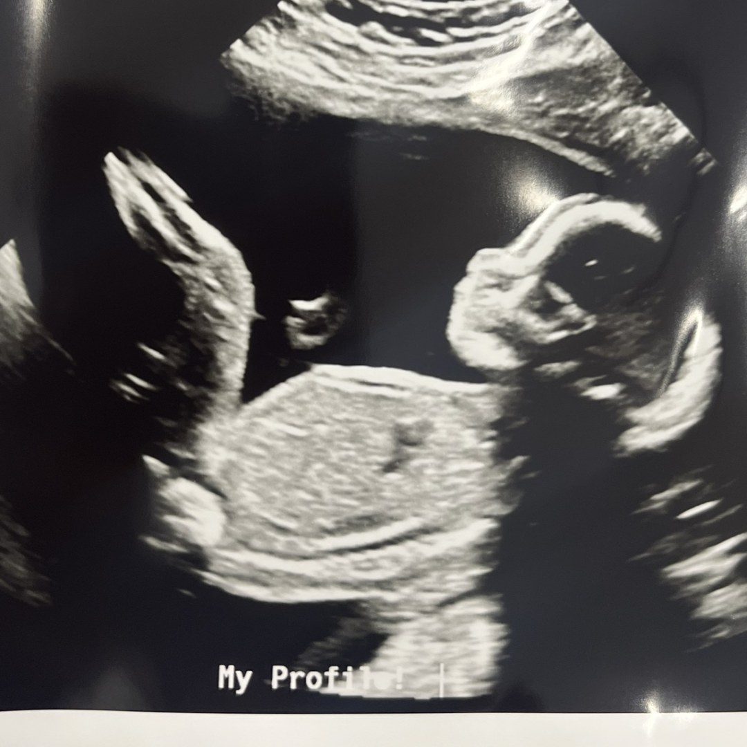 Photo shared by Paola for their Babylist baby registry.