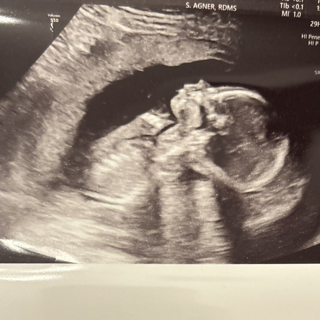 Photo shared by Chiara for their Babylist baby registry.