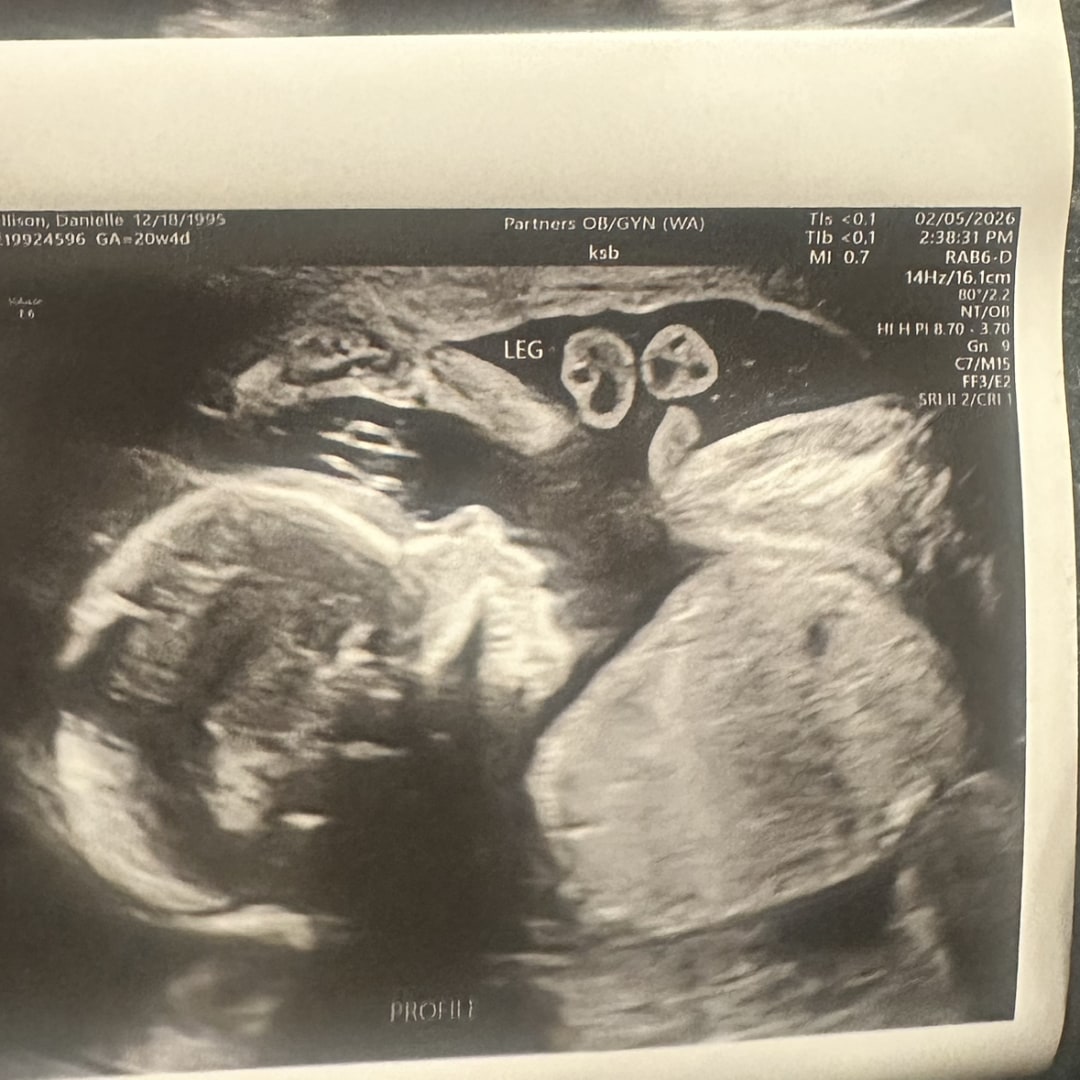 Photo shared by Danielle for their Babylist baby registry.