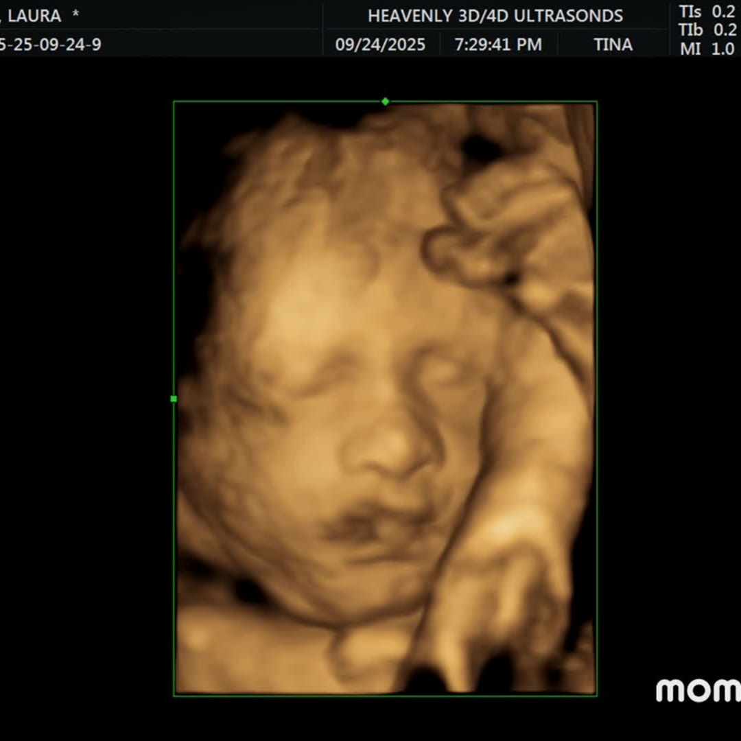 Photo shared by Laura for their Babylist baby registry.
