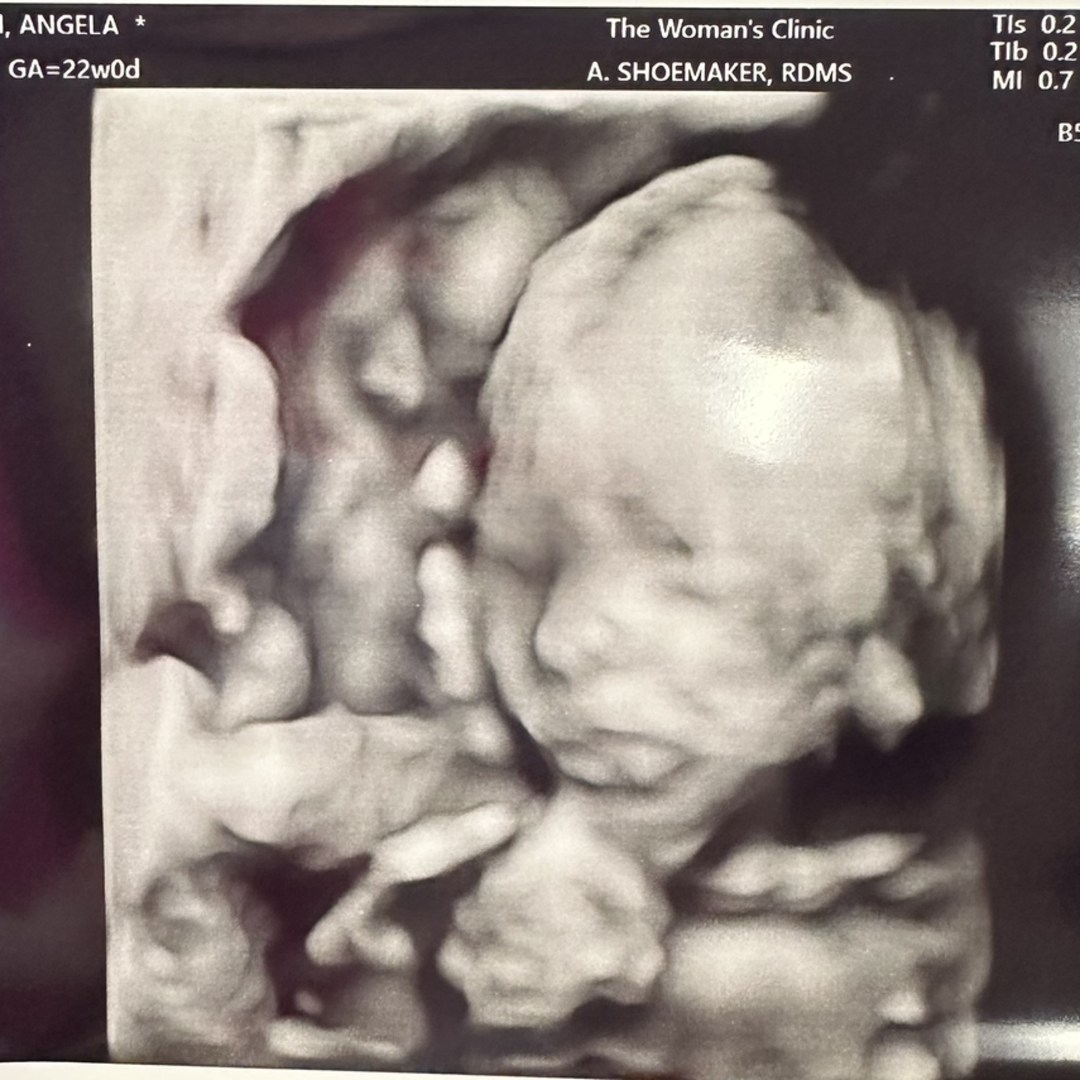 Photo shared by Angie for their Babylist baby registry.