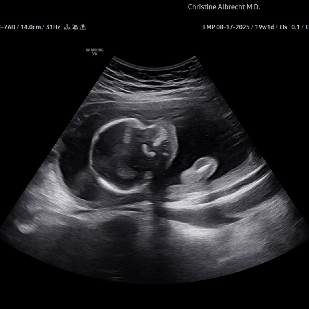 Photo shared by Jailyn for their Babylist baby registry.