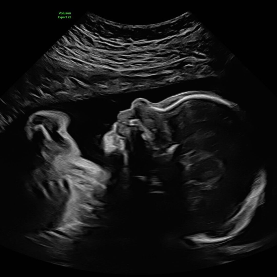 Photo shared by Lindsay for their Babylist baby registry.