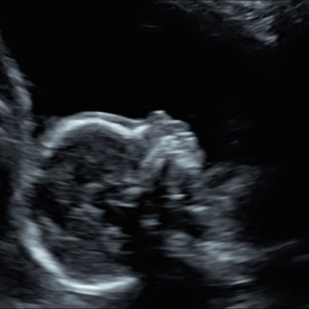 Photo shared by Elaine for their Babylist baby registry.