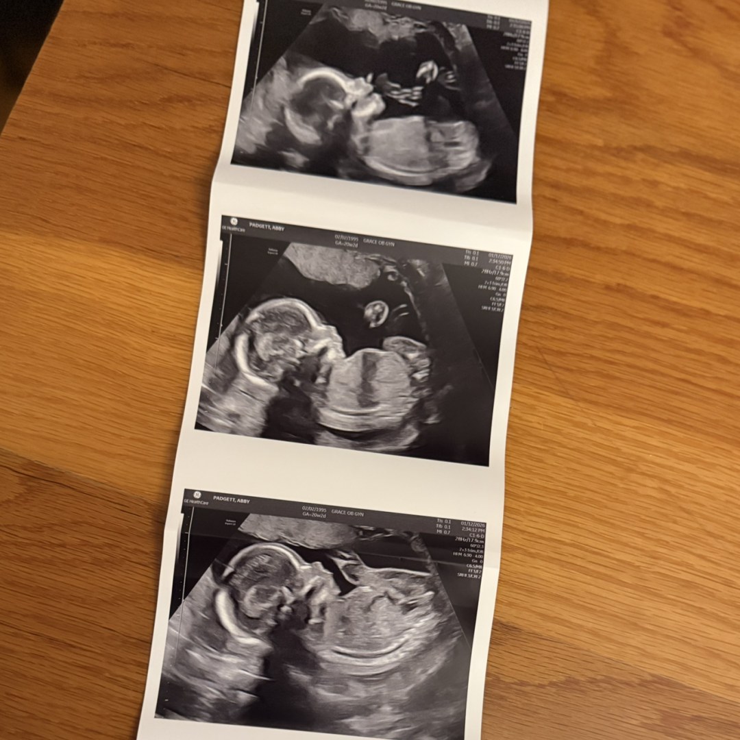 Photo shared by Abby for their Babylist baby registry.