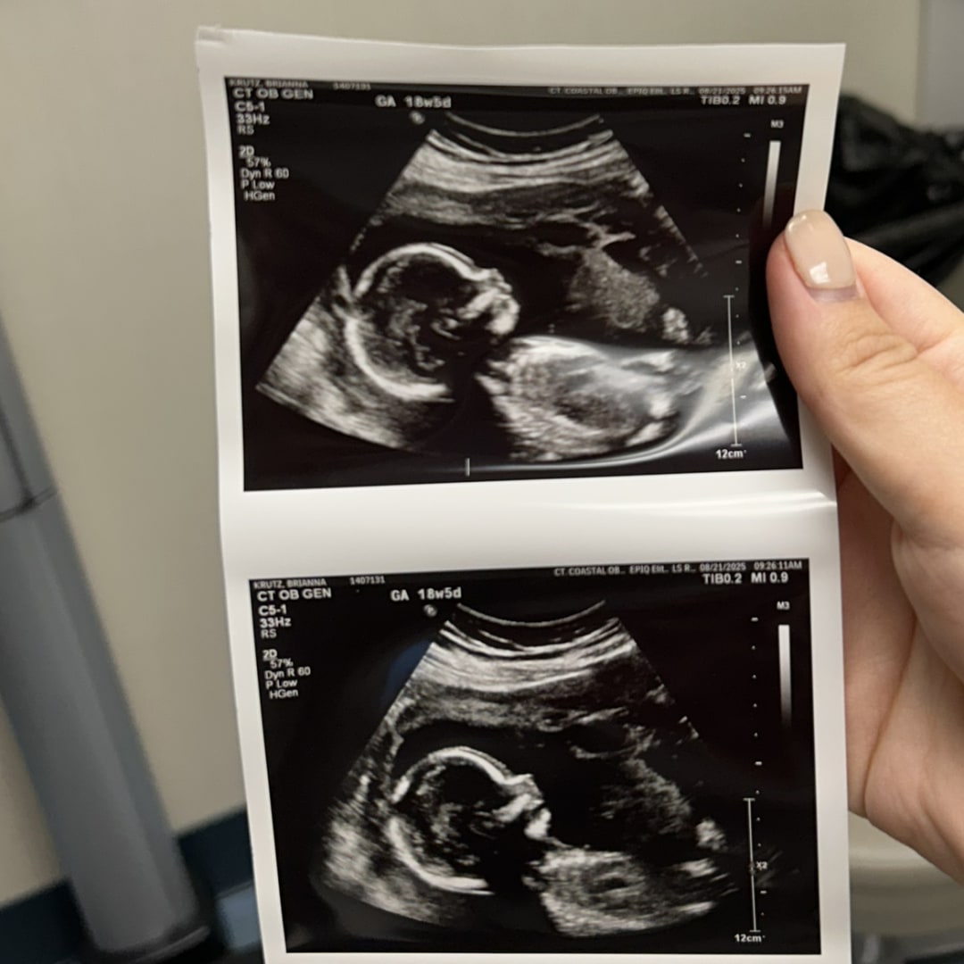 Photo shared by Brianna for their Babylist baby registry.