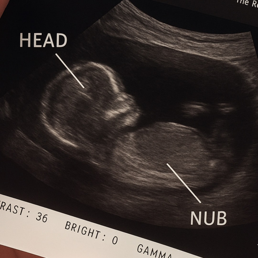 Photo shared by Taylor for their Babylist baby registry.