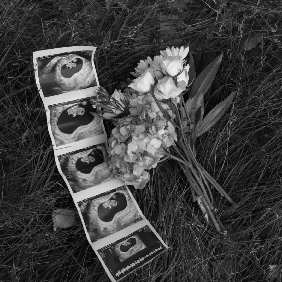 Photo shared by Makenna for their Babylist baby registry.