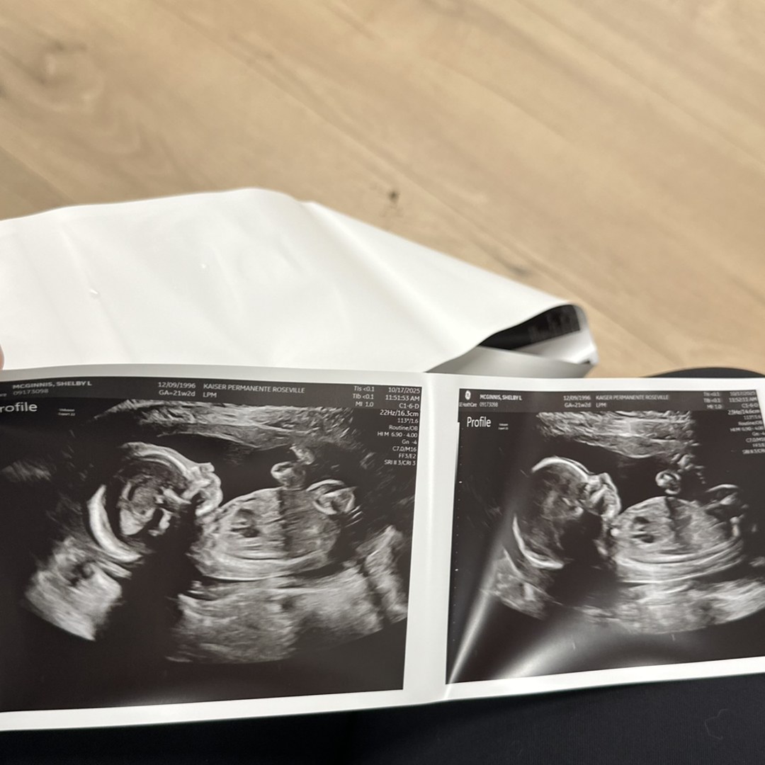 Photo shared by Shelby for their Babylist baby registry.