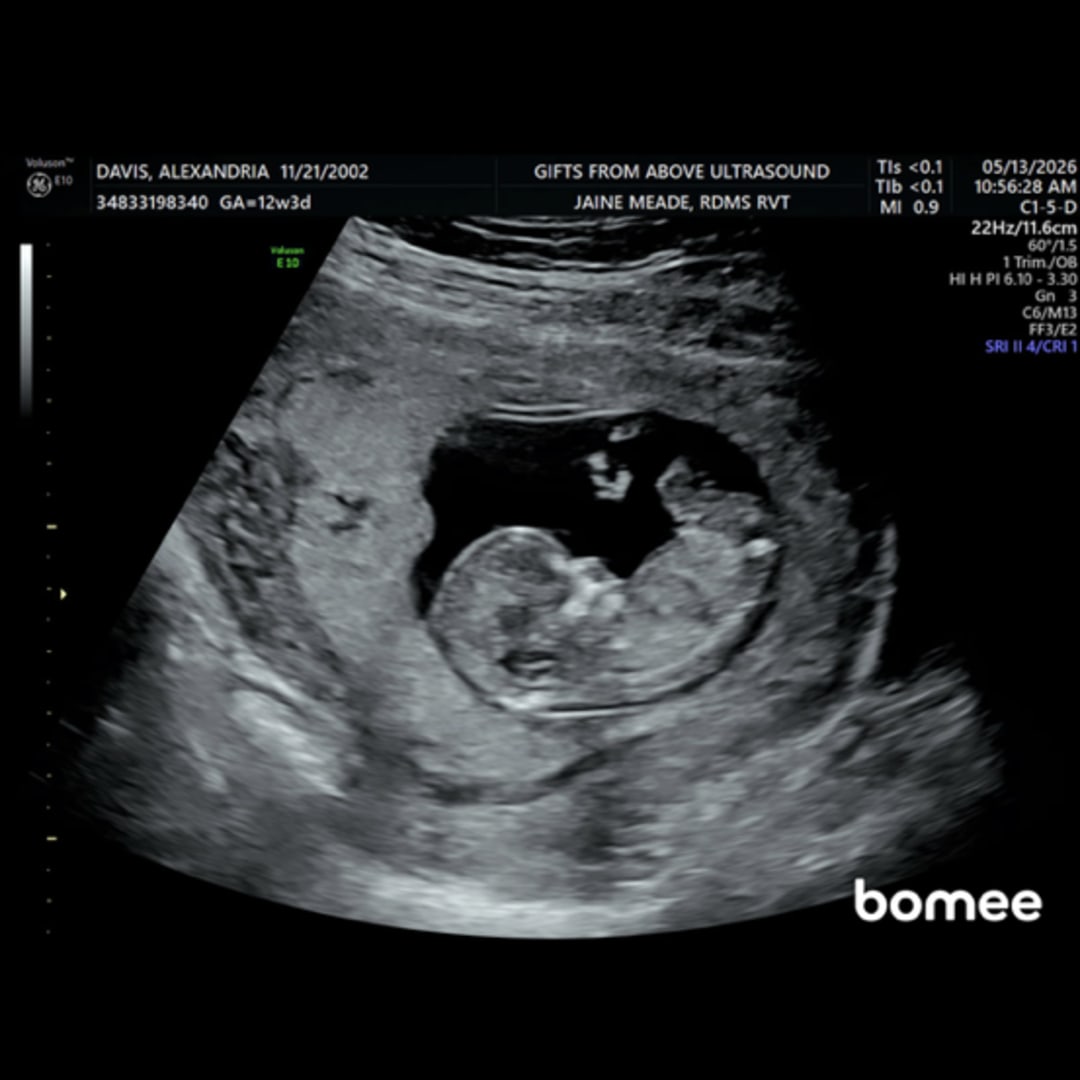 Photo shared by Alexandria for their Babylist baby registry.