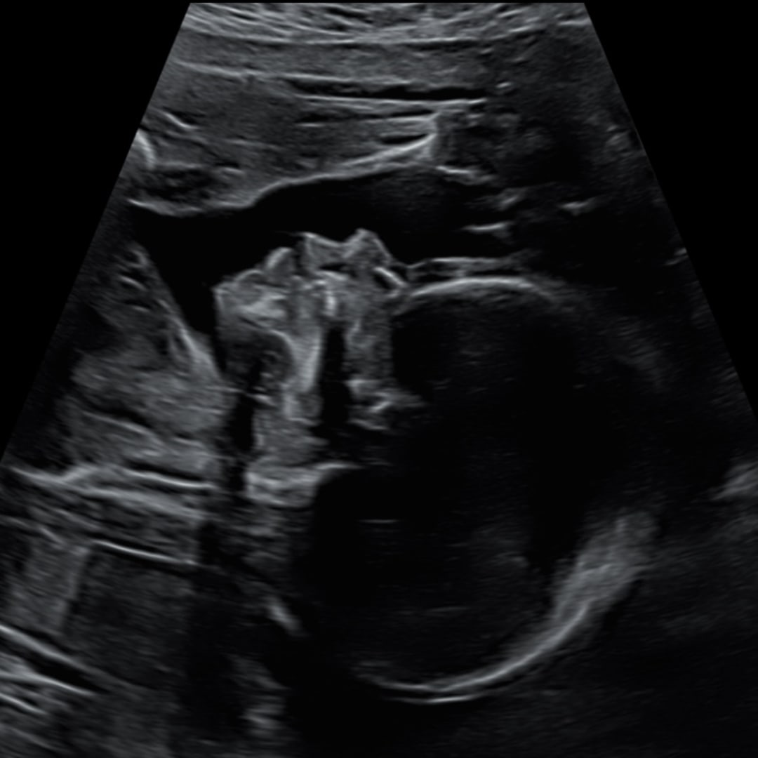 Photo shared by Jade for their Babylist baby registry.