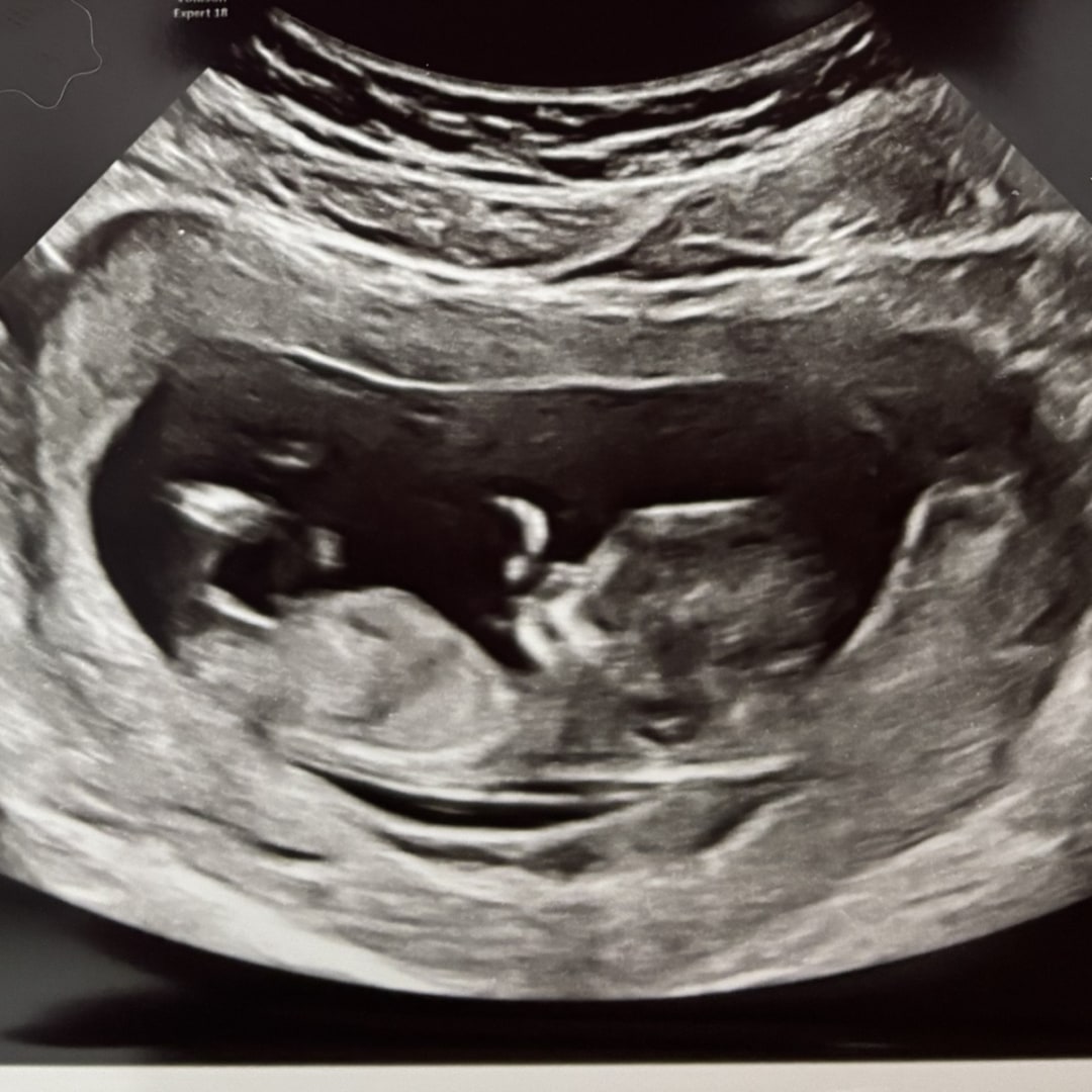 Photo shared by Allie for their Babylist baby registry.