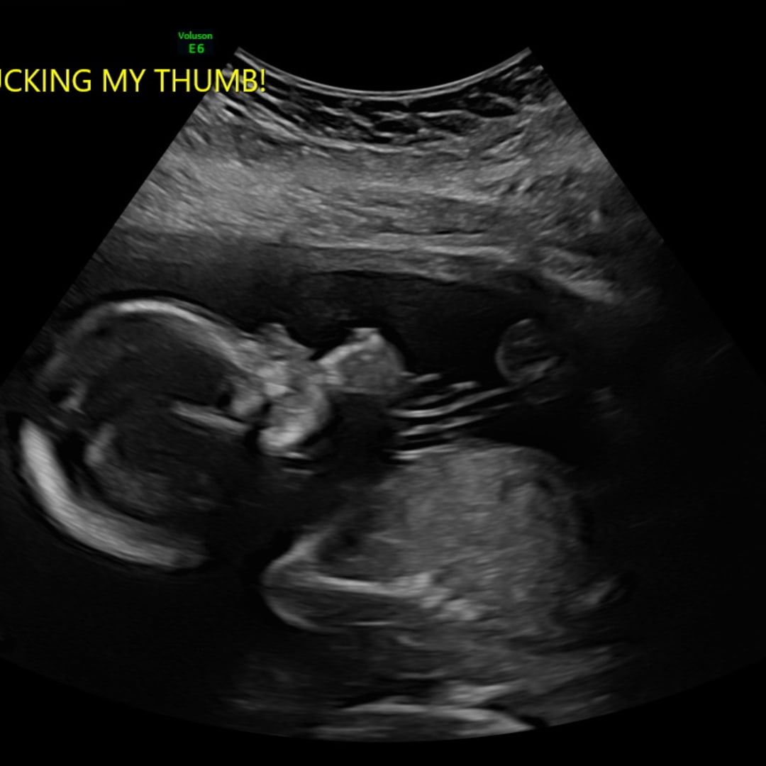 Photo shared by Aariel for their Babylist baby registry.