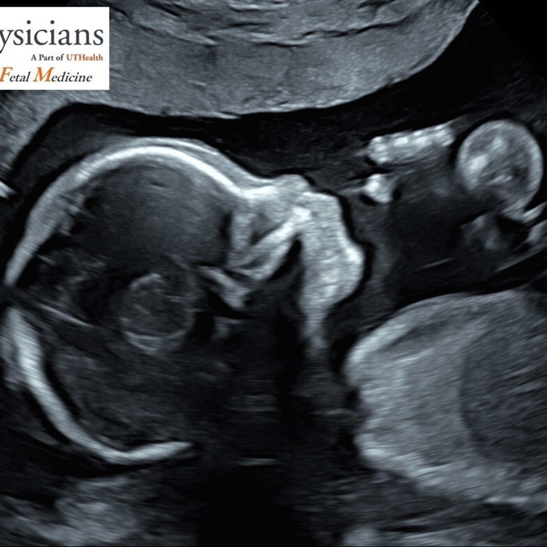 Photo shared by Kelley for their Babylist baby registry.