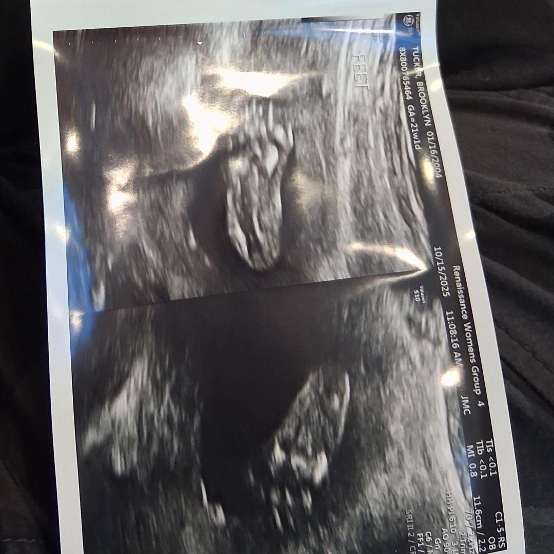 Photo shared by Brooklyn for their Babylist baby registry.