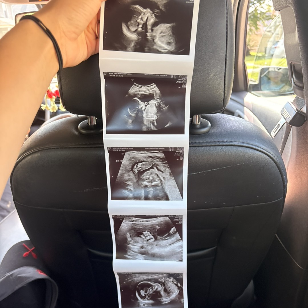 Photo shared by Haylee for their Babylist baby registry.