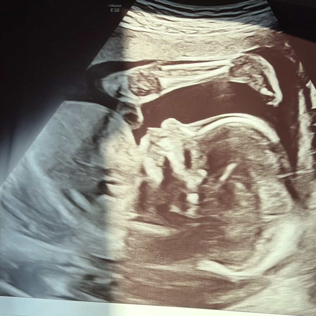 Photo shared by Natalie for their Babylist baby registry.