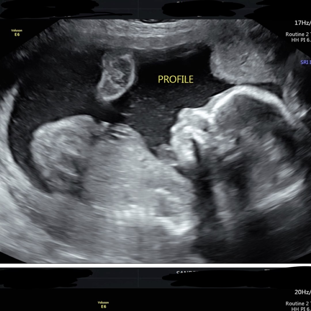Photo shared by Pressley for their Babylist baby registry.