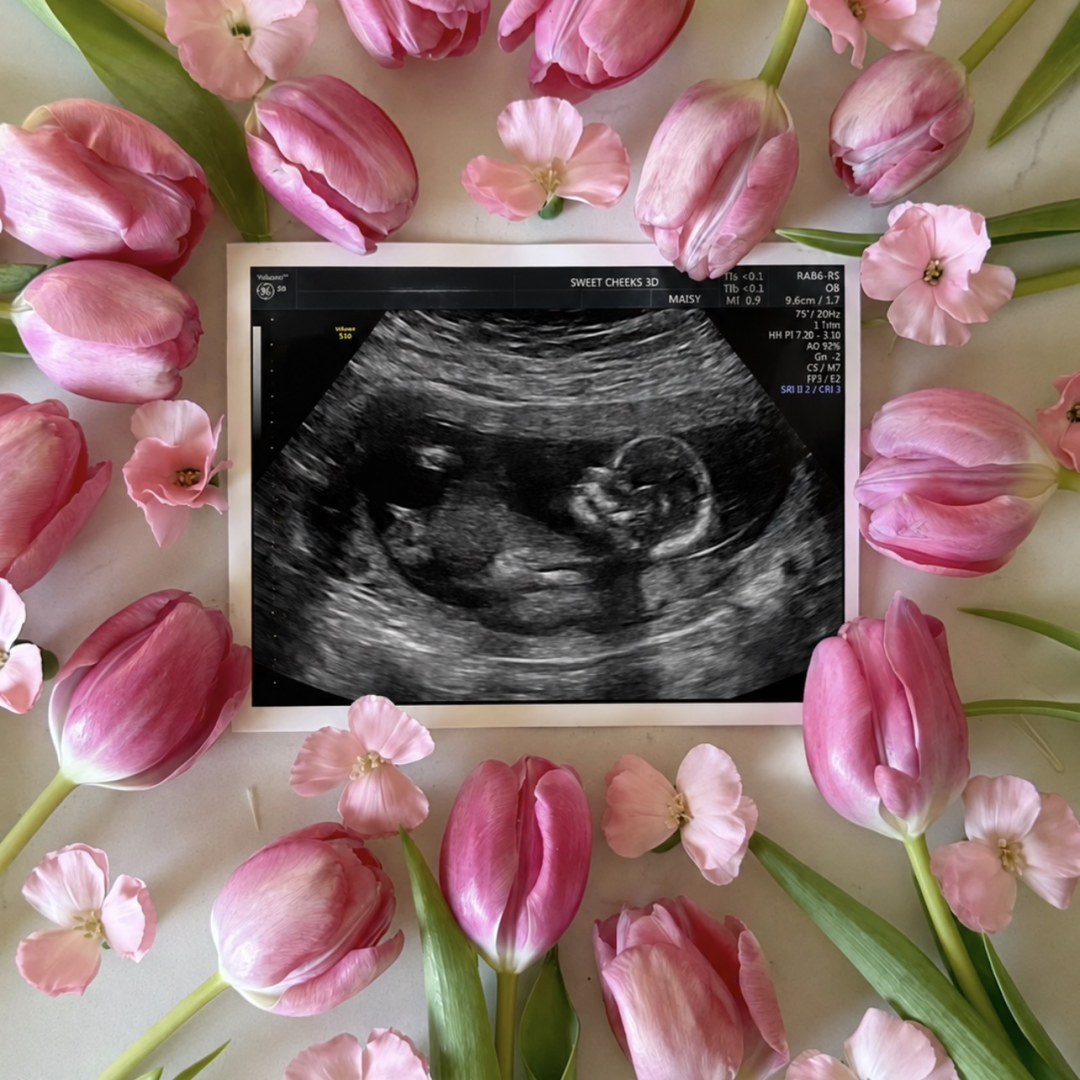 Photo shared by Kaylee for their Babylist baby registry.