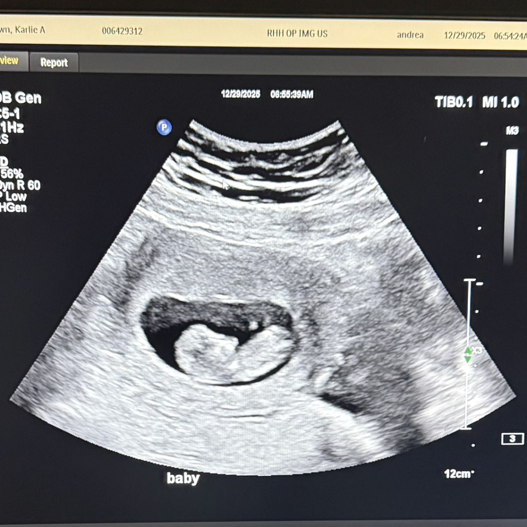 Photo shared by Nickolas for their Babylist baby registry.