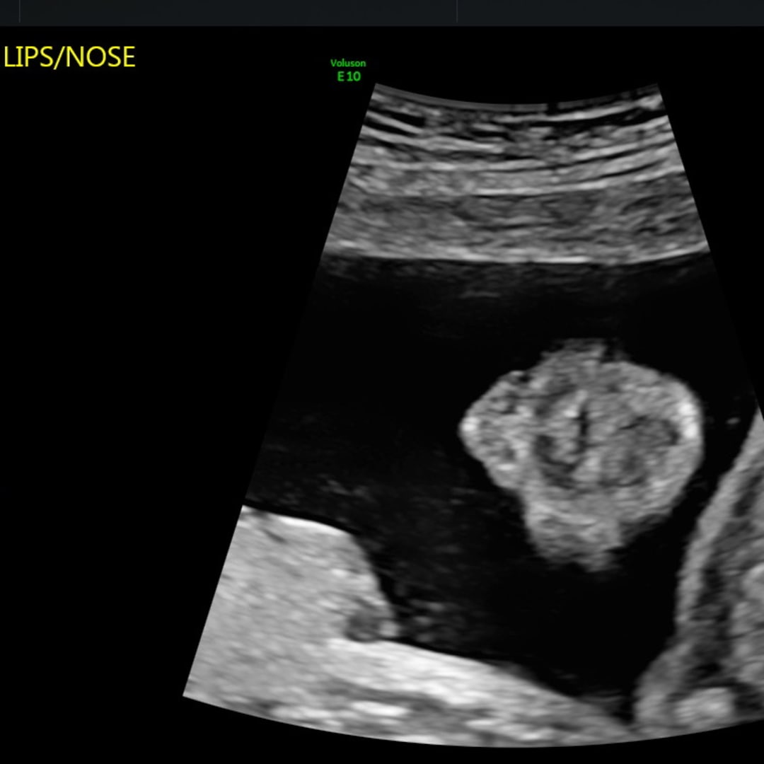 Photo shared by Tre & Kae for their Babylist baby registry.