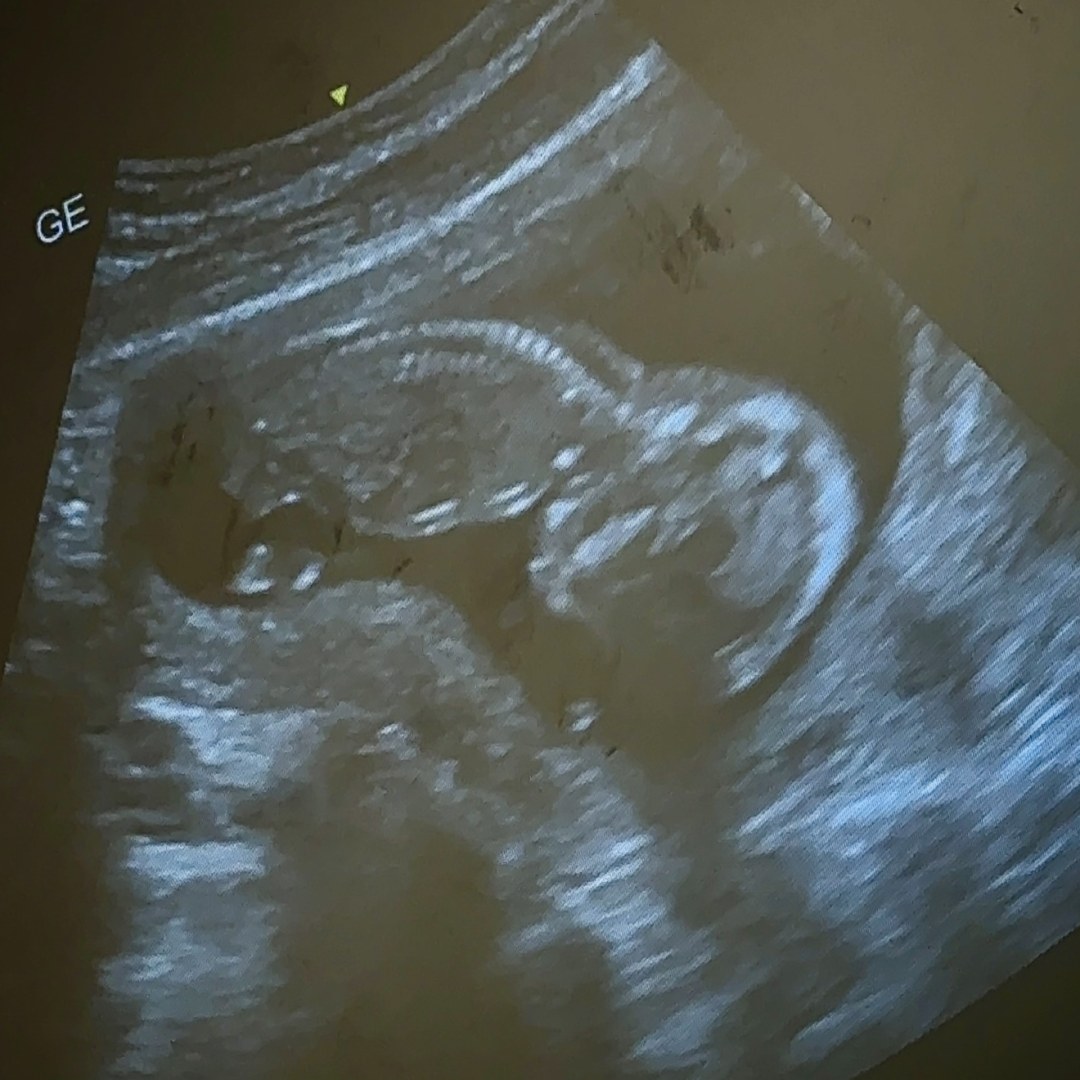 Photo shared by Angela for their Babylist baby registry.