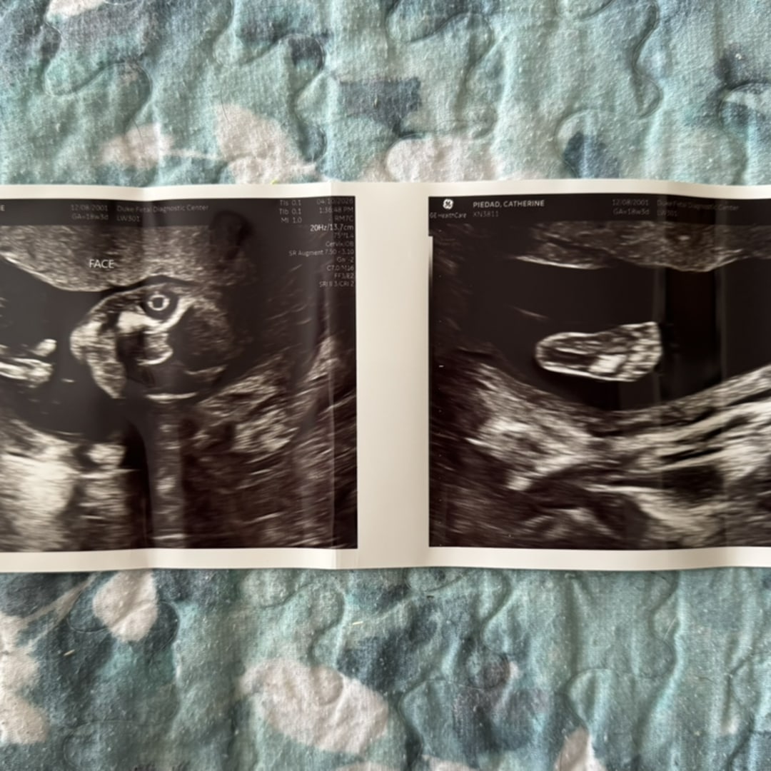 Photo shared by Catherine for their Babylist baby registry.