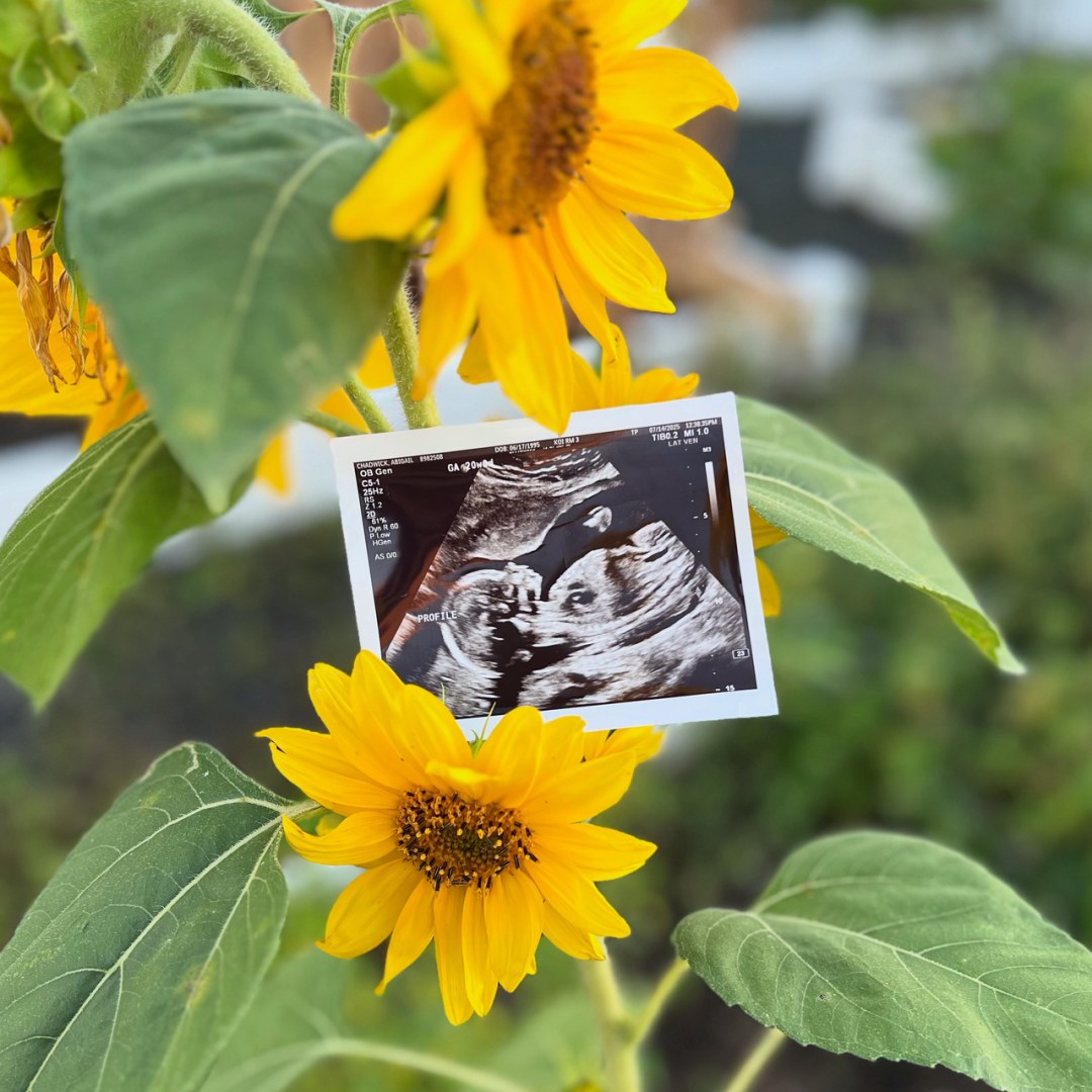 Photo shared by Abby for their Babylist baby registry.