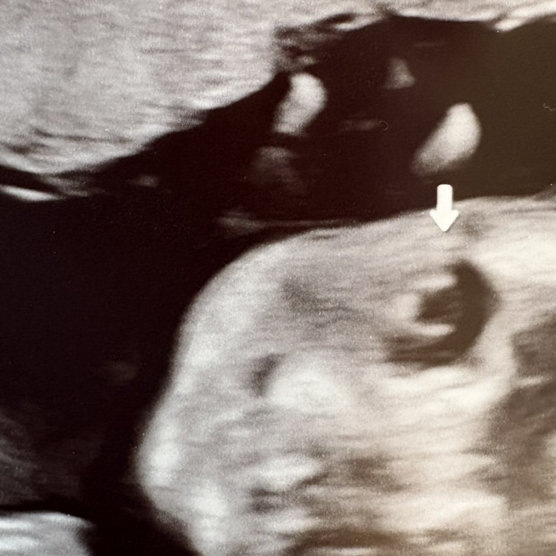 Photo shared by Erica for their Babylist baby registry.