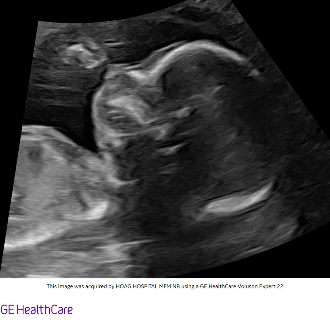 Photo shared by Zashya for their Babylist baby registry.