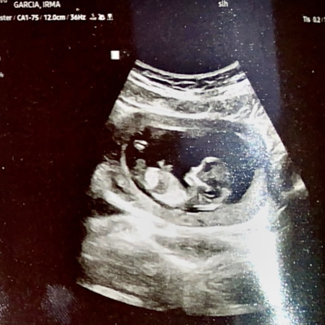 Photo shared by Irma for their Babylist baby registry.