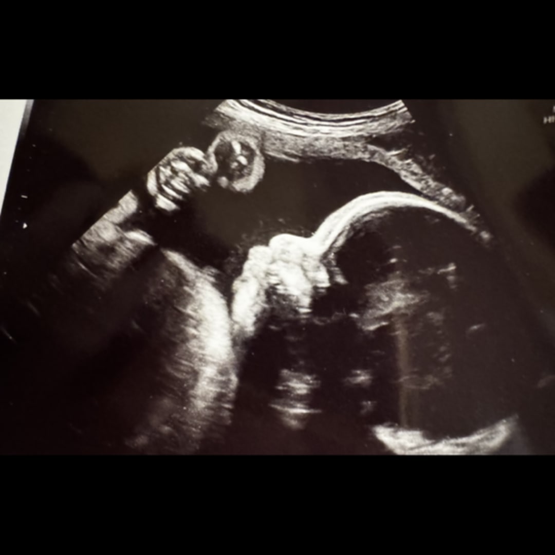 Photo shared by Britt for their Babylist baby registry.