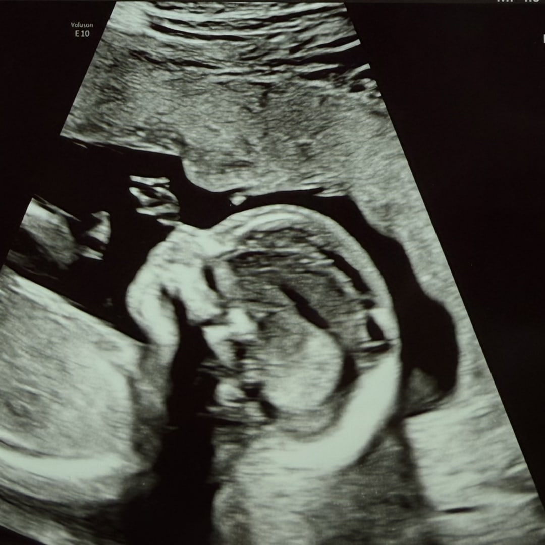 Photo shared by David for their Babylist baby registry.