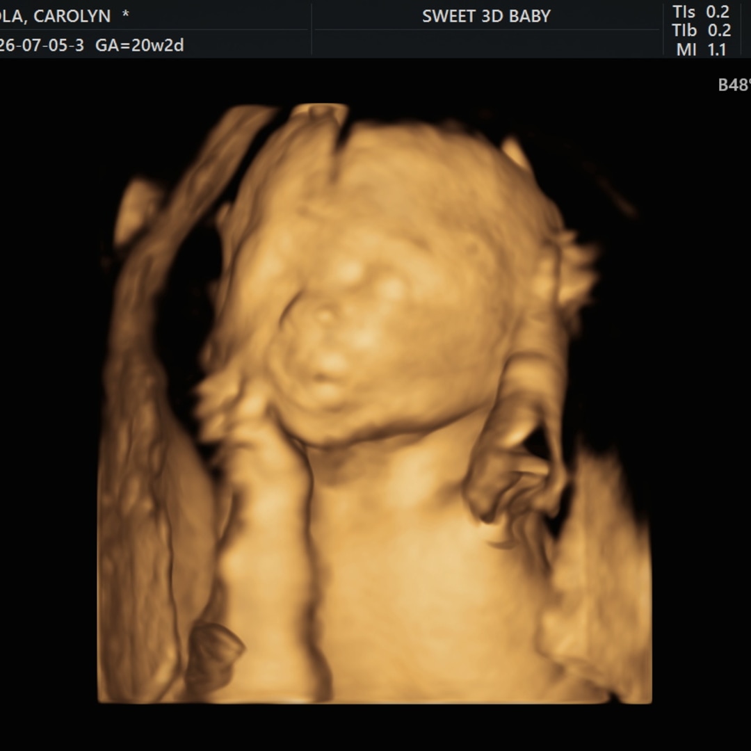 Photo shared by Carolyn for their Babylist baby registry.
