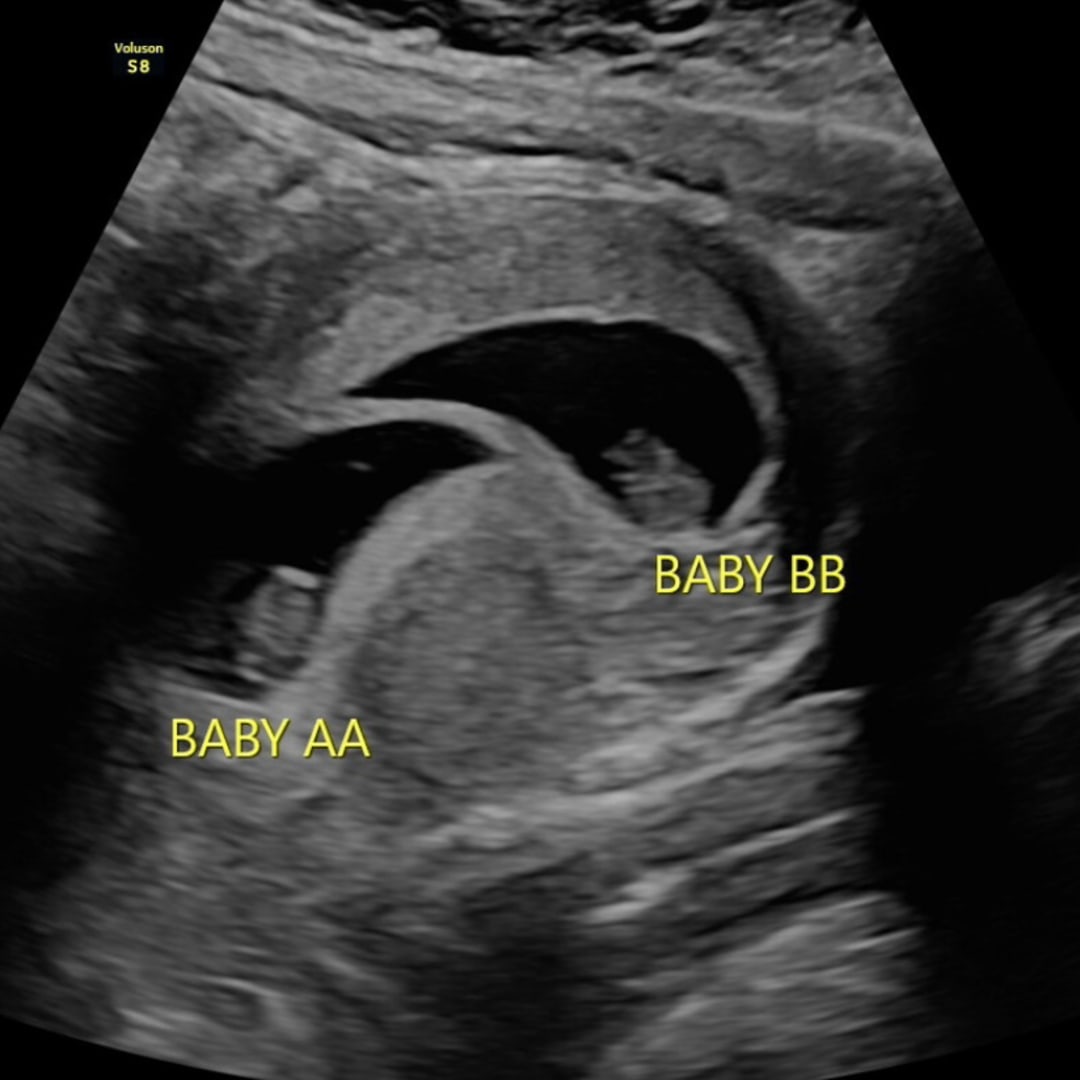Photo shared by Sydney for their Babylist baby registry.