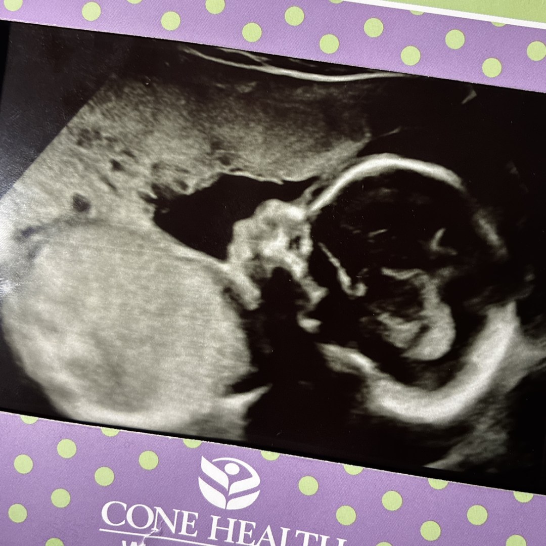 Photo shared by Serenity for their Babylist baby registry.
