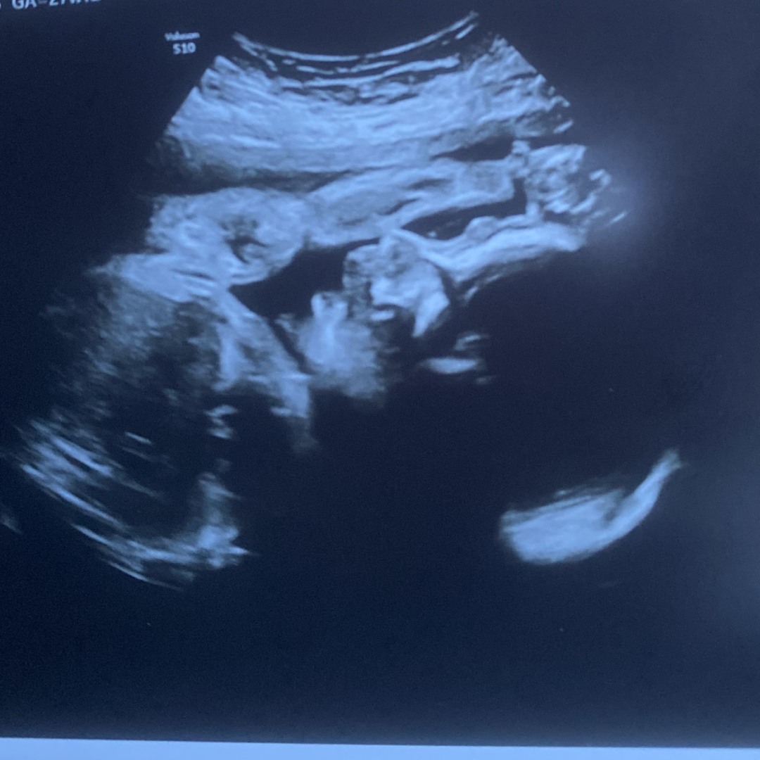 Photo shared by Kayleigh for their Babylist baby registry.