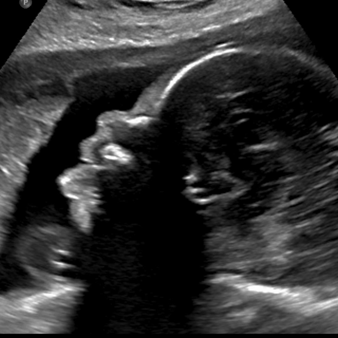 Photo shared by Emma for their Babylist baby registry.