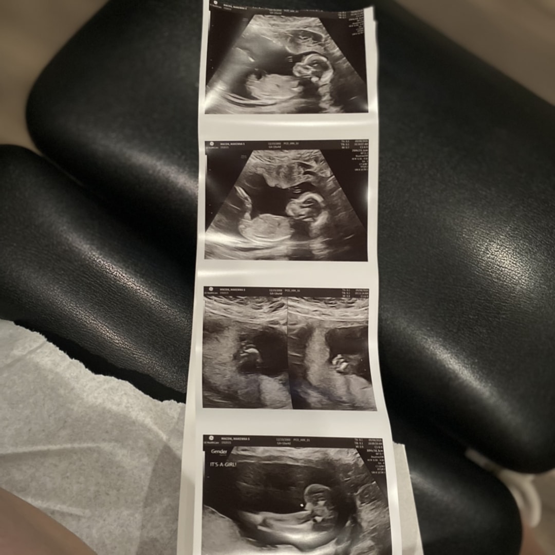 Photo shared by Makenna for their Babylist baby registry.