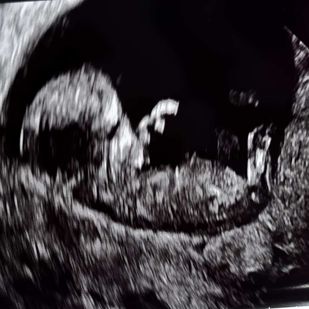 Photo shared by Malorie for their Babylist baby registry.
