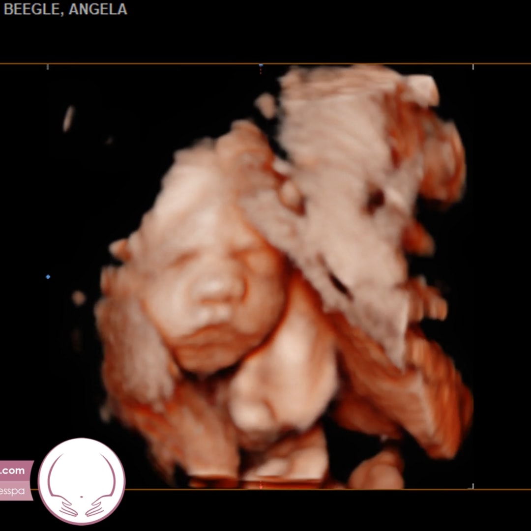 Photo shared by Angela for their Babylist baby registry.